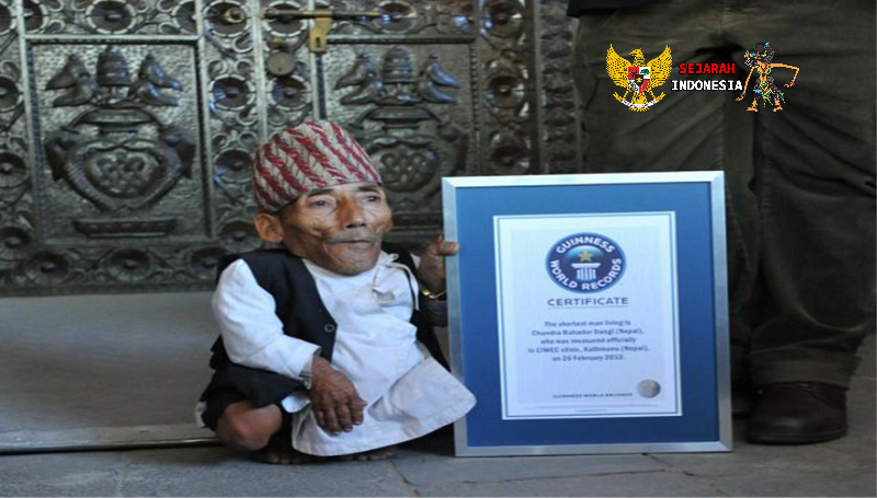 Kisah Hidup Manusia Terpendek di Dunia,dengan Tinggi 54,6 Cm