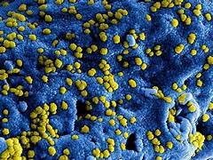 Pakar UI Ingatkan Risiko Wabah Baru Jika Hantavirus Bermutasi Antar Manusia